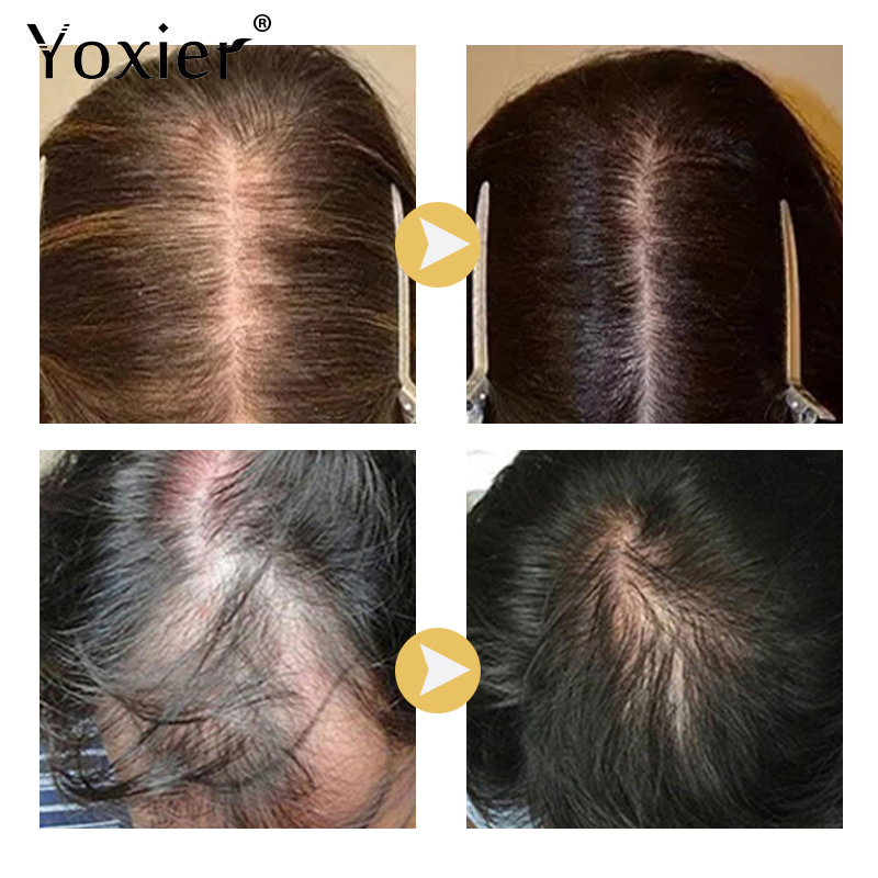 Intensive Wachstum Serum Verhi – Hair Care Growth Bewertung und Preis