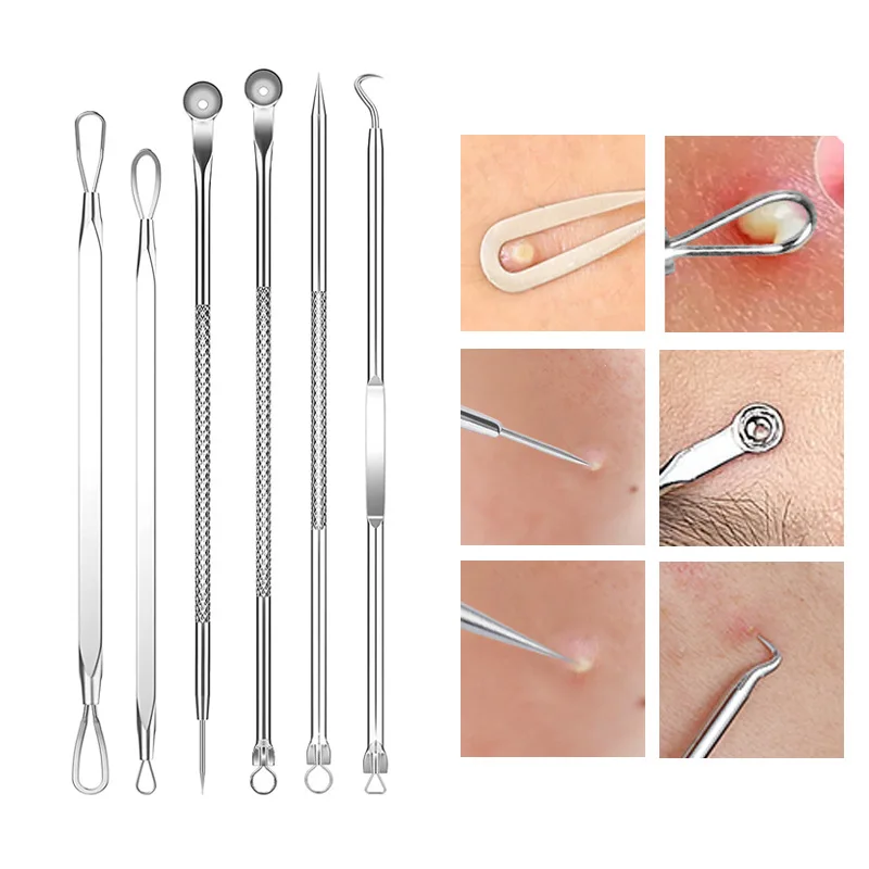 4-11Pcs Eingewachsene Haar Pin – Hair Care Clinic Bewertung und Preis