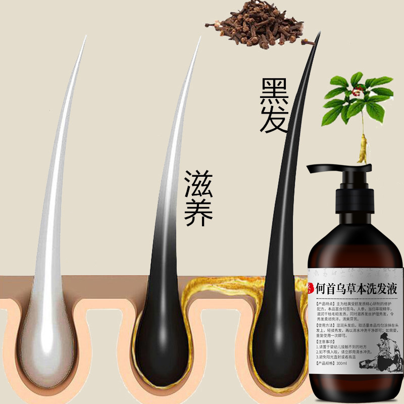 300ml Polygonum multiflorum sh – Hair Care Herbal Bewertung und Preis