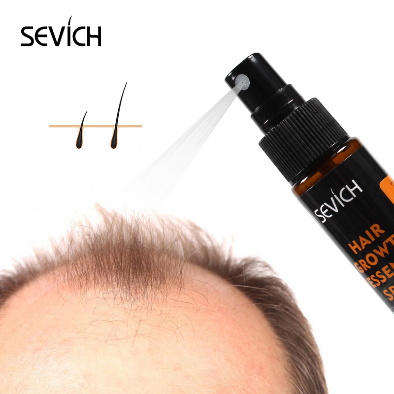 Sevich 30ml Hebal Öl Essenz Sc – Hair Care Herbal Bewertung und Preis