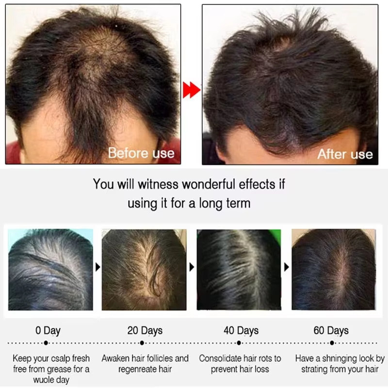 Schnelles Ingwer-Haarwuchsspra – Hair Care Growth Bewertung und Preis