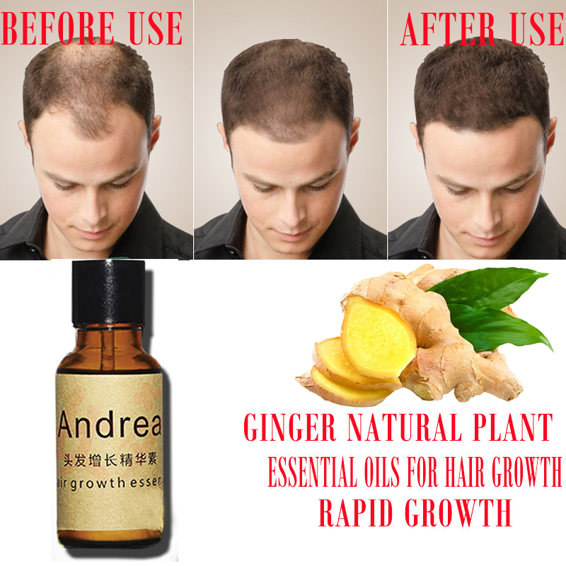 2/5/10Pcs Andrea Haar Wachstum – Hair Care Herbal Bewertung und Preis
