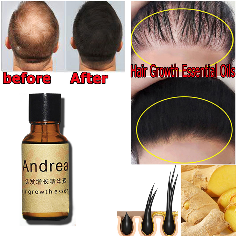 2/5/10Pcs Andrea Haar Wachstum – Hair Care Herbal Bewertung und Preis