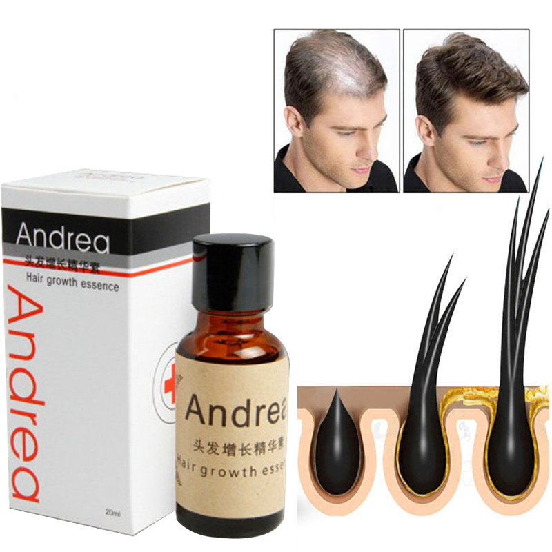 2/5/10Pcs Andrea Haar Wachstum – Hair Care Herbal Bewertung und Preis